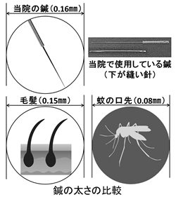 一心治療院で使用している鍼の口径の比較