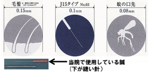 鍼の比較画像