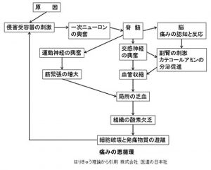 痛みの悪循環