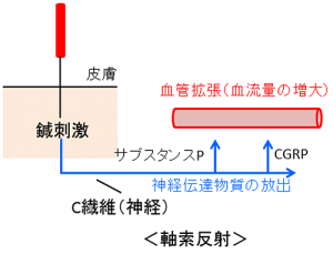 軸索反射