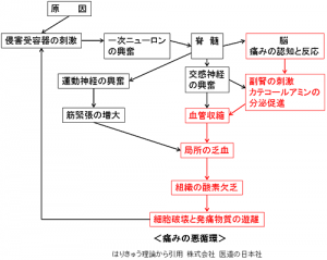 痛みの悪循環