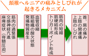 頚椎ヘルニアメカニズム