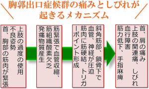胸郭出口症候群のメカニズム