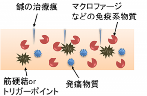 鍼治療の免疫作用