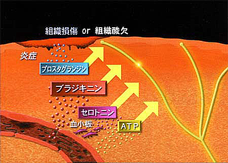 発痛物質