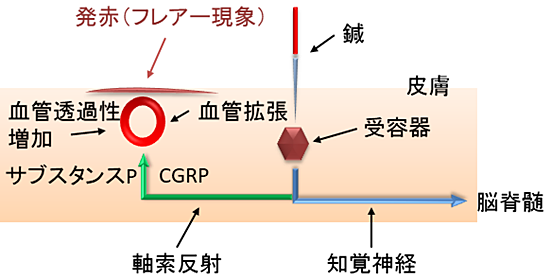 フレアー現象