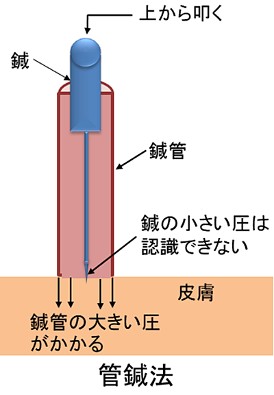 鍼