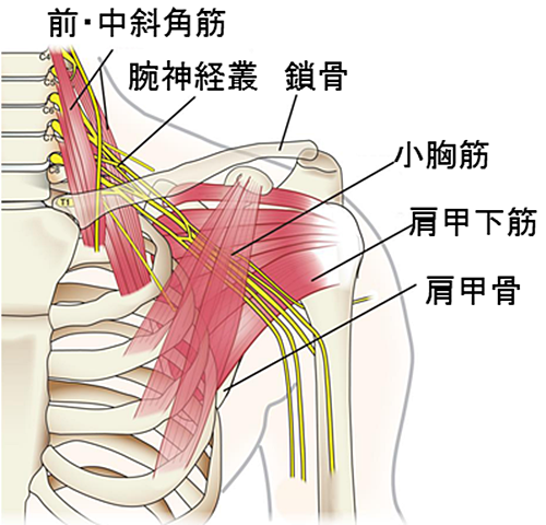 トレ 筋 胸郭 症候群 出口 いかり肩となで肩と胸郭出口症候群 ｜